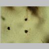 Oligodendroglia Golgil 09.jpg